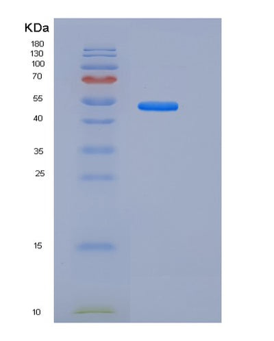 SDS-PAGE analysis of Human MSLN (Mesothelin) - Recombinant Protein, CAT# BLT-06034P, showing >90% purity under 15% SDS-PAGE (Reduced)Human MSLN (Mesothelin) - Recombinant Protein