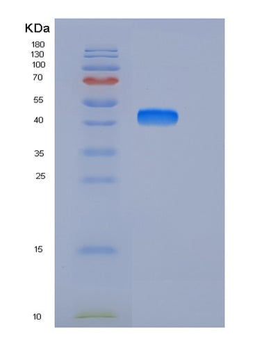 SDS-PAGE analysis of Human DDR1 (Epithelial Discoidin Domain-Containing Receptor 1) - Recombinant Protein, CAT# BLT-06036P, showing >90% purity under 15% SDS-PAGE (Reduced)Human DDR1 (Epithelial Discoidin Domain-Containing Receptor 1) - Recombinant Protein