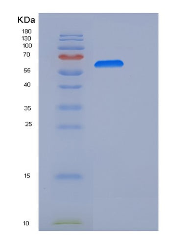 SDS-PAGE analysis of Human NCAM1 (Neural Cell Adhesion Molecule 1) - Recombinant Protein, CAT# BLT-06038P, showing >90% purity under 15% SDS-PAGE (Reduced)Human NCAM1 (Neural Cell Adhesion Molecule 1) - Recombinant Protein