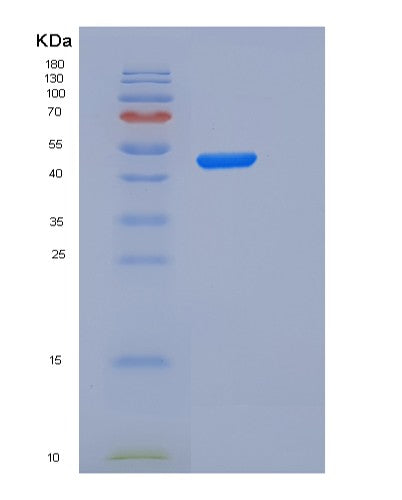 SDS-PAGE analysis of Human IL2RA (Interleukin-2 Receptor Subunit Alpha) - Recombinant Protein, CATHuman IL2RA (Interleukin-2 Receptor Subunit Alpha) - Recombinant Protein