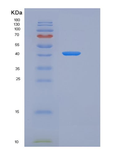 SDS-PAGE analysis of Human CFH (Complement Factor H) - Recombinant Protein, CAT# BLT-06043P, showing >90% purity under 15% SDS-PAGE (Reduced)Human CFH (Complement Factor H) - Recombinant Protein