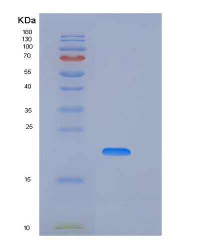 SDS-PAGE analysis of Human NCR2 (Natural Cytotoxicity Triggering Receptor 2) - Recombinant Protein, CAT# BLT-06047P, showing >85% purity under 15% SDS-PAGE (Reduced)Human NCR2 (Natural Cytotoxicity Triggering Receptor 2) - Recombinant Protein