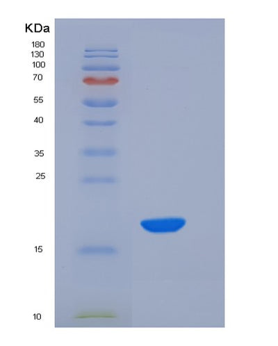 SDS-PAGE analysis of Mouse Nbl1 (Neuroblastoma Suppressor Of Tumorigenicity 1) - Recombinant Protein, CAT# BLT-06051P, showing >90% purity under 15% SDS-PAGE (Reduced)Mouse Nbl1 (Neuroblastoma Suppressor Of Tumorigenicity 1) - Recombinant Protein