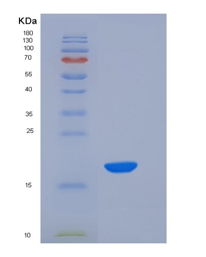 SDS-PAGE analysis of Mouse Nbl1 (Neuroblastoma Suppressor Of Tumorigenicity 1) - Recombinant Protein, CATMouse Nbl1 (Neuroblastoma Suppressor Of Tumorigenicity 1) - Recombinant Protein