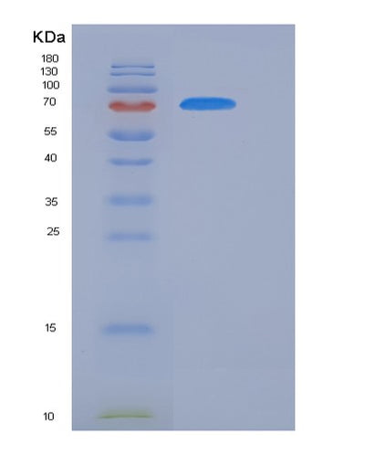 SDS-PAGE analysis of Human FOLH1 (Glutamate Carboxypeptidase 2) - Recombinant Protein, CAT# BLT-06054P, showing >85% purity under 15% SDS-PAGE (Reduced)Human FOLH1 (Glutamate Carboxypeptidase 2) - Recombinant Protein