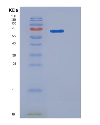 SDS-PAGE analysis of Human ROR1 (Inactive Tyrosine-Protein Kinase Transmembrane Receptor Ror1) - Recombinant Protein, CAT# BLT-06055P, showing >85% purity under 15% SDS-PAGE (Reduced)Human ROR1 (Inactive Tyrosine-Protein Kinase Transmembrane Receptor Ror1) - Recombinant Protein