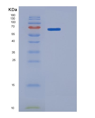 SDS-PAGE analysis of Human ROR1 (Inactive Tyrosine-Protein Kinase Transmembrane Receptor Ror1) - Recombinant Protein, CATHuman ROR1 (Inactive Tyrosine-Protein Kinase Transmembrane Receptor Ror1) - Recombinant Protein