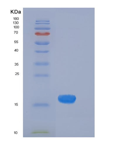 SDS-PAGE analysis of Human CST4 (Cystatin-S) - Recombinant Protein, CAT# BLT-06057P, showing >90% purity under 15% SDS-PAGE (Reduced)Human CST4 (Cystatin-S) - Recombinant Protein