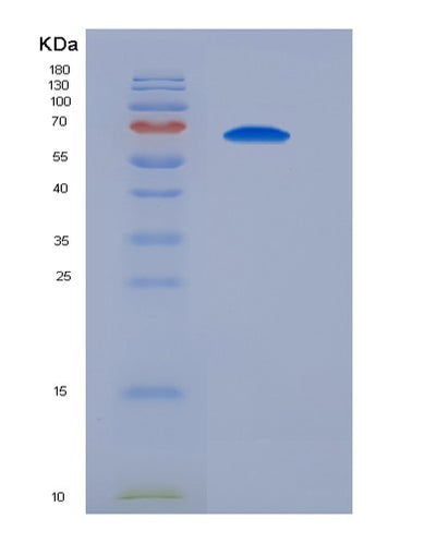 SDS-PAGE analysis of Mouse Sirpa (Tyrosine-Protein Phosphatase Non-Receptor Type Substrate 1) - Recombinant Protein, CAT# BLT-06059P, showing >90% purity under 15% SDS-PAGE (Reduced)Mouse Sirpa (Tyrosine-Protein Phosphatase Non-Receptor Type Substrate 1) - Recombinant Protein