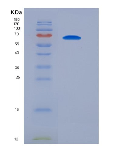 SDS-PAGE analysis of Mouse Sirpa (Tyrosine-Protein Phosphatase Non-Receptor Type Substrate 1) - Recombinant Protein, CATMouse Sirpa (Tyrosine-Protein Phosphatase Non-Receptor Type Substrate 1) - Recombinant Protein