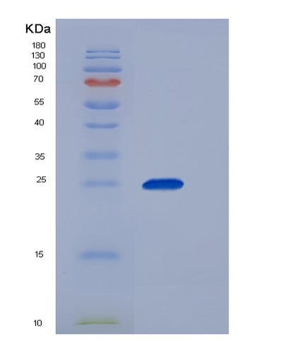 SDS-PAGE analysis of Human CFD (Complement Factor D) - Recombinant Protein, CAT# BLT-06061P, showing >95% purity under 15% SDS-PAGE (Reduced)Human CFD (Complement Factor D) - Recombinant Protein