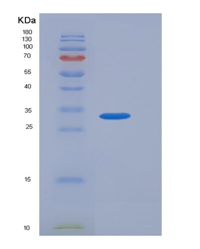 SDS-PAGE analysis of Human CTSZ (Cathepsin Z) - Recombinant Protein, CAT# BLT-06065P, showing >85% purity under 15% SDS-PAGE (Reduced)Human CTSZ (Cathepsin Z) - Recombinant Protein