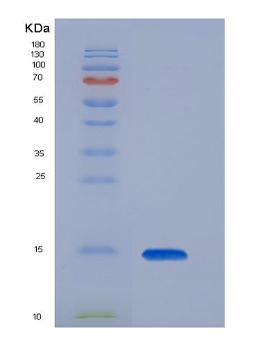 SDS-PAGE analysis of Mouse TIGIT - Recombinant Protein, CAT# BLT-08429P showing >85% purity under 15% SDS-PAGE (Reduced)Mouse TIGIT - Recombinant Protein