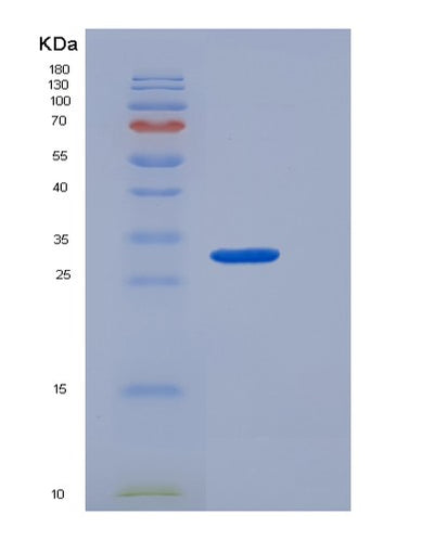 SDS-PAGE analysis of Human CTRC (Chymotrypsin-C) - Recombinant Protein, CAT# BLT-06069P, showing >95% purity under 15% SDS-PAGE (Reduced)Human CTRC (Chymotrypsin-C) - Recombinant Protein