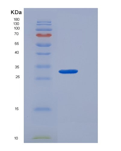 SDS-PAGE analysis of Human CTRC (Chymotrypsin-C) - Recombinant Protein, CATHuman CTRC (Chymotrypsin-C) - Recombinant Protein