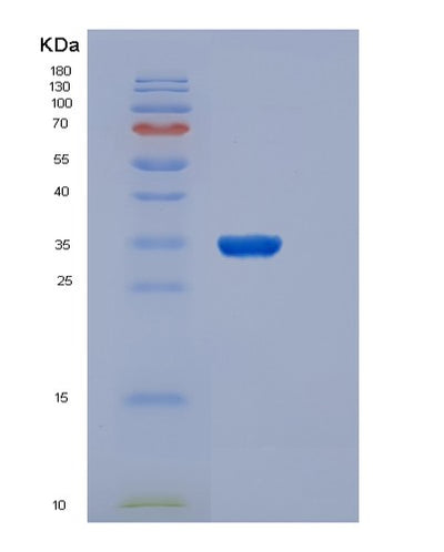 SDS-PAGE analysis of Human CSF2RA (Granulocyte-Macrophage Colony-Stimulating Factor Receptor Subunit Alpha) - Recombinant Protein, CAT# BLT-06073P, showing >90% purity under 15% SDS-PAGE (Reduced)Human CSF2RA (Granulocyte-Macrophage Colony-Stimulating Factor Receptor Subunit Alpha) - Recombinant Protein