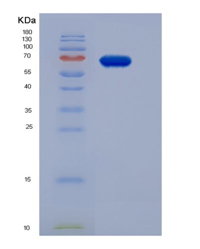 SDS-PAGE analysis of Human PGA4 (Pepsin A-4) - Recombinant Protein, CAT# BLT-06081P, showing >85% purity under 15% SDS-PAGE (Reduced)Human PGA4 (Pepsin A-4) - Recombinant Protein