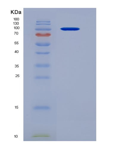 SDS-PAGE analysis of Human TEK (Angiopoietin-1 Receptor) - Recombinant Protein, CAT# BLT-06082P, showing >95% purity under 15% SDS-PAGE (Reduced)Human TEK (Angiopoietin-1 Receptor) - Recombinant Protein