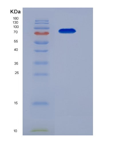 SDS-PAGE analysis of Mouse Tgfbr3 (Transforming Growth Factor Beta Receptor Type 3) - Recombinant Protein, CATMouse Tgfbr3 (Transforming Growth Factor Beta Receptor Type 3) - Recombinant Protein