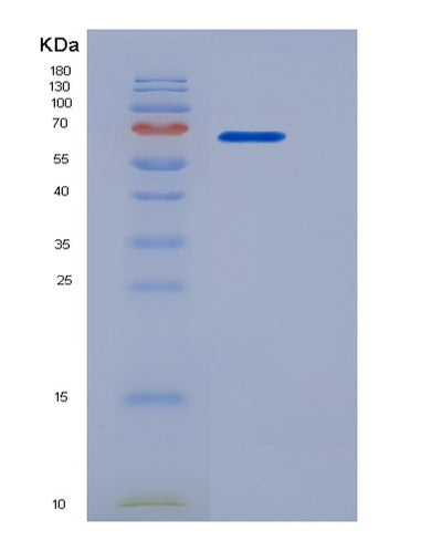 SDS-PAGE analysis of Human CD180 (Cd180 Antigen) - Recombinant Protein, CAT# BLT-06095P, showing >95% purity under 15% SDS-PAGE (Reduced)Human CD180 (Cd180 Antigen) - Recombinant Protein