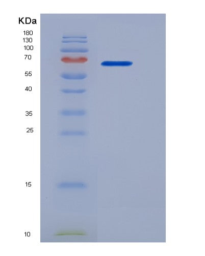 SDS-PAGE analysis of Human CD180 (Cd180 Antigen) - Recombinant Protein, CATHuman CD180 (Cd180 Antigen) - Recombinant Protein