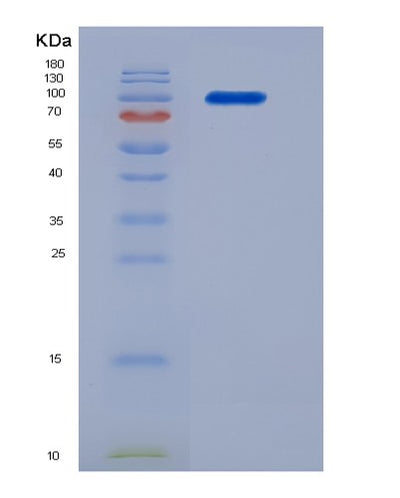 SDS-PAGE analysis of Human MET (Hepatocyte Growth Factor Receptor) - Recombinant Protein, CAT# BLT-06096P, showing >90% purity under 15% SDS-PAGE (Reduced)Human MET (Hepatocyte Growth Factor Receptor) - Recombinant Protein