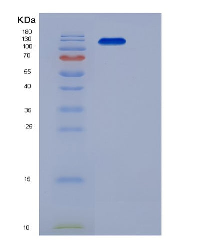 SDS-PAGE analysis of Human MET (Hepatocyte Growth Factor Receptor) - Recombinant Protein, CAT# BLT-06101P, showing >95% purity under 15% SDS-PAGE (Reduced)Human MET (Hepatocyte Growth Factor Receptor) - Recombinant Protein