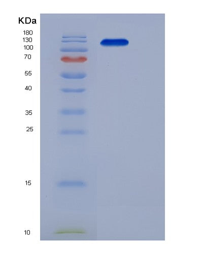 SDS-PAGE analysis of Human MET (Hepatocyte Growth Factor Receptor) - Recombinant Protein, CATHuman MET (Hepatocyte Growth Factor Receptor) - Recombinant Protein