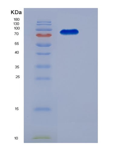 SDS-PAGE analysis of Mouse Kit (Mast/Stem Cell Growth Factor Receptor Kit) - Recombinant Protein, CAT# BLT-06103P, showing >85% purity under 15% SDS-PAGE (Reduced)Mouse Kit (Mast/Stem Cell Growth Factor Receptor Kit) - Recombinant Protein