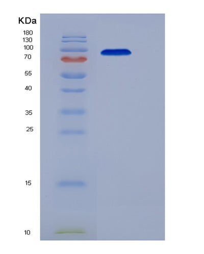 SDS-PAGE analysis of Human ENPP2 (Autotaxin) - Recombinant Protein, CAT# BLT-06106P, showing >95% purity under 15% SDS-PAGE (Reduced)Human ENPP2 (Autotaxin) - Recombinant Protein