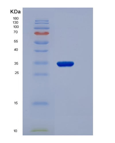 SDS-PAGE analysis of Human NMNAT1 (Nicotinamide/Nicotinic Acid Mononucleotide Adenylyltransferase 1) - Recombinant Protein, CAT# BLT-06108P, showing >85% purity under 15% SDS-PAGE (Reduced)Human NMNAT1 (Nicotinamide/Nicotinic Acid Mononucleotide Adenylyltransferase 1) - Recombinant Protein