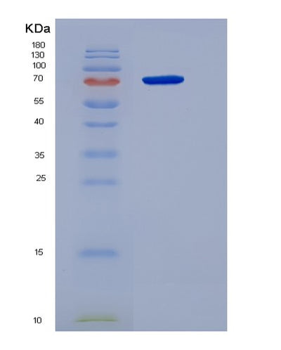 SDS-PAGE analysis of Human GPNMB (Transmembrane Glycoprotein Nmb) - Recombinant Protein, CAT# BLT-06110P, showing >90% purity under 15% SDS-PAGE (Reduced)Human GPNMB (Transmembrane Glycoprotein Nmb) - Recombinant Protein