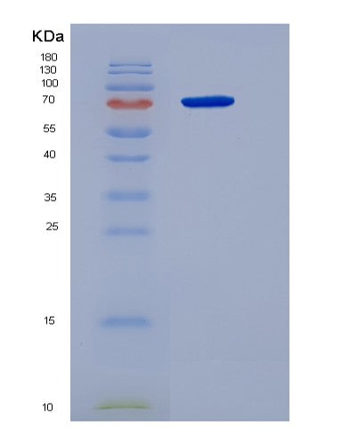 SDS-PAGE analysis of Human GPNMB (Transmembrane Glycoprotein Nmb) - Recombinant Protein, CATHuman GPNMB (Transmembrane Glycoprotein Nmb) - Recombinant Protein