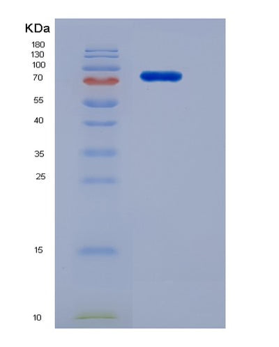 SDS-PAGE analysis of Human FLT1 (Vascular Endothelial Growth Factor Receptor 1) - Recombinant Protein, CAT# BLT-06112P, showing >95% purity under 15% SDS-PAGE (Reduced)Human FLT1 (Vascular Endothelial Growth Factor Receptor 1) - Recombinant Protein