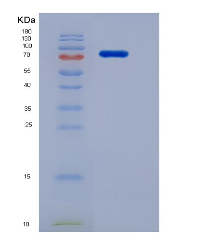 SDS-PAGE analysis of Human FLT1 (Vascular Endothelial Growth Factor Receptor 1) - Recombinant Protein, CATHuman FLT1 (Vascular Endothelial Growth Factor Receptor 1) - Recombinant Protein