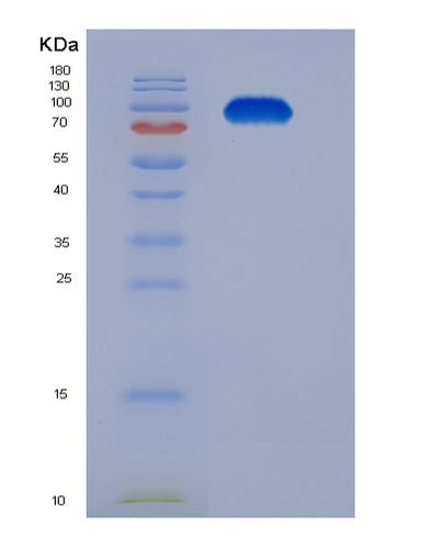 SDS-PAGE analysis of Mouse Tfrc (Transferrin Receptor Protein 1) - Recombinant Protein, CAT# BLT-06117P, showing >85% purity under 15% SDS-PAGE (Reduced)Mouse Tfrc (Transferrin Receptor Protein 1) - Recombinant Protein