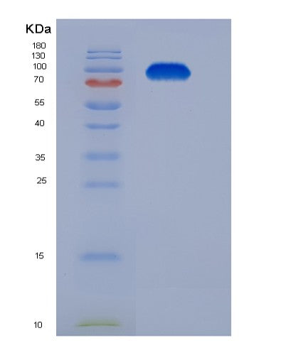 SDS-PAGE analysis of Mouse Tfrc (Transferrin Receptor Protein 1) - Recombinant Protein, CATMouse Tfrc (Transferrin Receptor Protein 1) - Recombinant Protein