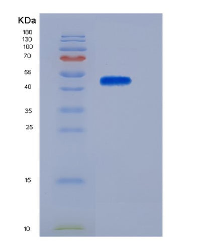 SDS-PAGE analysis of Mouse Klrb1f (Killer Cell Lectin-Like Receptor Subfamily B Member 1F) - Recombinant Protein, CAT# BLT-06128P, showing >85% purity under 15% SDS-PAGE (Reduced)Mouse Klrb1f (Killer Cell Lectin-Like Receptor Subfamily B Member 1F) - Recombinant Protein