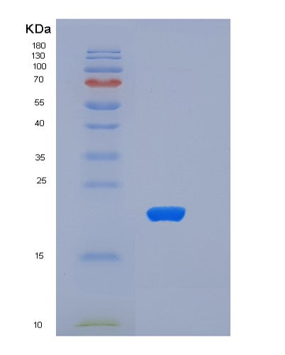 SDS-PAGE analysis of Mouse Tnfrsf1a (Tumor Necrosis Factor Receptor Superfamily Member 1A) - Recombinant Protein, CATMouse Tnfrsf1a (Tumor Necrosis Factor Receptor Superfamily Member 1A) - Recombinant Protein