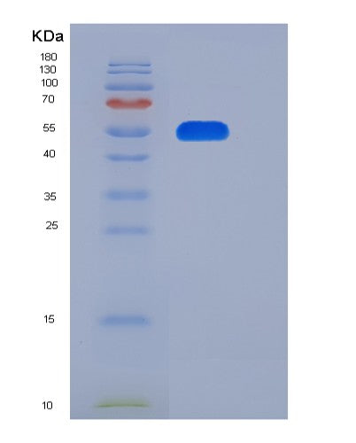 SDS-PAGE analysis of Human FLRT1 (Leucine-Rich Repeat Transmembrane Protein Flrt1) - Recombinant Protein, CATHuman FLRT1 (Leucine-Rich Repeat Transmembrane Protein Flrt1) - Recombinant Protein