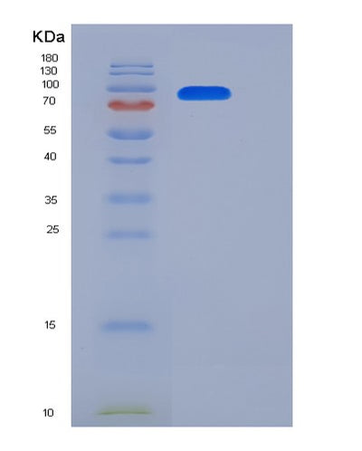 SDS-PAGE analysis of Mouse Erbb2 (Receptor Tyrosine-Protein Kinase Erbb-2) - Recombinant Protein, CAT# BLT-06143P, showing >90% purity under 15% SDS-PAGE (Reduced)Mouse Erbb2 (Receptor Tyrosine-Protein Kinase Erbb-2) - Recombinant Protein