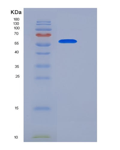 SDS-PAGE analysis of Human CD68 (Macrosialin) - Recombinant Protein, CAT# BLT-06148P, showing >95% purity under 15% SDS-PAGE (Reduced)Human CD68 (Macrosialin) - Recombinant Protein