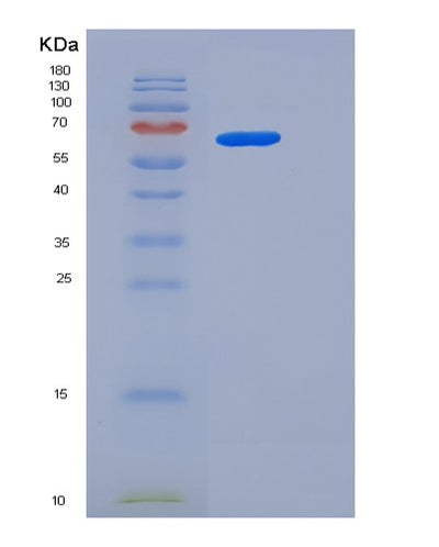 SDS-PAGE analysis of Human USH1C (Harmonin) - Recombinant Protein, CAT# BLT-06154P, showing >95% purity under 15% SDS-PAGE (Reduced)Human USH1C (Harmonin) - Recombinant Protein