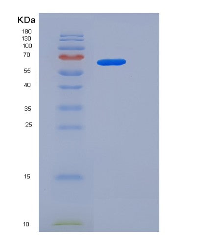 SDS-PAGE analysis of Human USH1C (Harmonin) - Recombinant Protein, CATHuman USH1C (Harmonin) - Recombinant Protein