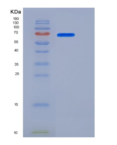 SDS-PAGE analysis of Mouse Cd180 (Cd180 Antigen) - Recombinant Protein, CAT# BLT-06155P, showing >90% purity under 15% SDS-PAGE (Reduced)Mouse Cd180 (Cd180 Antigen) - Recombinant Protein