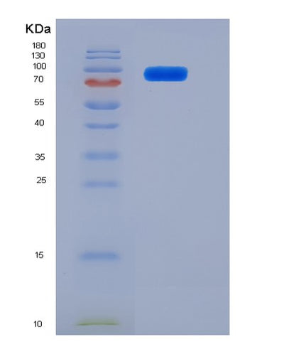 SDS-PAGE analysis of Mouse Cd180 (Cd180 Antigen) - Recombinant Protein, CAT# BLT-06159P, showing >85% purity under 15% SDS-PAGE (Reduced)Mouse Cd180 (Cd180 Antigen) - Recombinant Protein