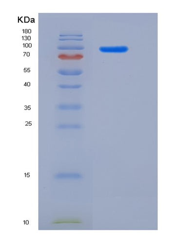 SDS-PAGE analysis of Human CDH17 (Cadherin-17) - Recombinant Protein, CAT# BLT-06165P, showing >85% purity under 15% SDS-PAGE (Reduced)Human CDH17 (Cadherin-17) - Recombinant Protein