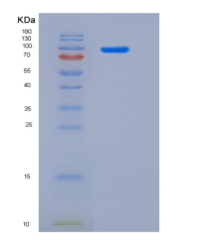SDS-PAGE analysis of Human CDH17 (Cadherin-17) - Recombinant Protein, CATHuman CDH17 (Cadherin-17) - Recombinant Protein