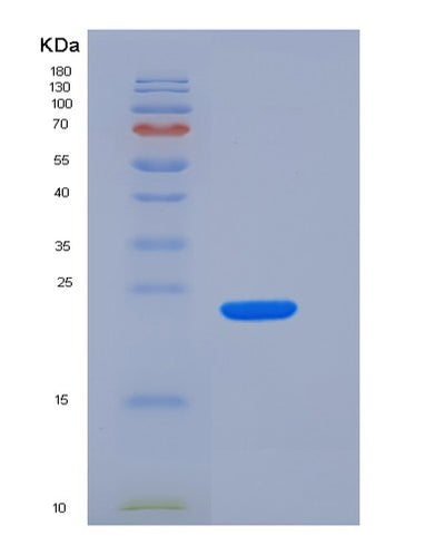 SDS-PAGE analysis of Human SLAMF7 (Slam Family Member 7) - Recombinant Protein, CAT# BLT-06172P, showing >95% purity under 15% SDS-PAGE (Reduced)Human SLAMF7 (Slam Family Member 7) - Recombinant Protein