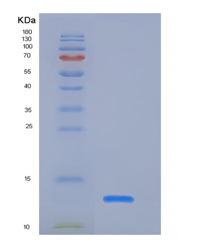 SDS-PAGE analysis of Human ACVR1B (Activin Receptor Type-1B) - Recombinant Protein, CAT# BLT-06174P, showing >85% purity under 15% SDS-PAGE (Reduced)Human ACVR1B (Activin Receptor Type-1B) - Recombinant Protein